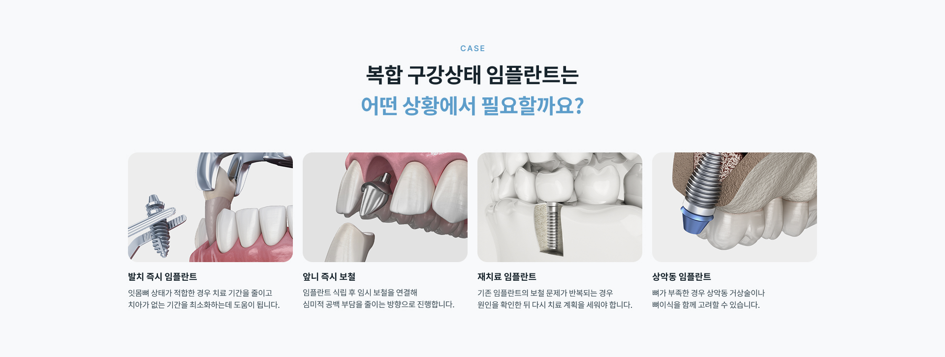 정성플러스치과 복합 구강상태 임플란트의 3D 정밀 진단, 뼈 상태 맞춤 치료, 신경과 상악동 위치 고려 및 재치료 원인 확인