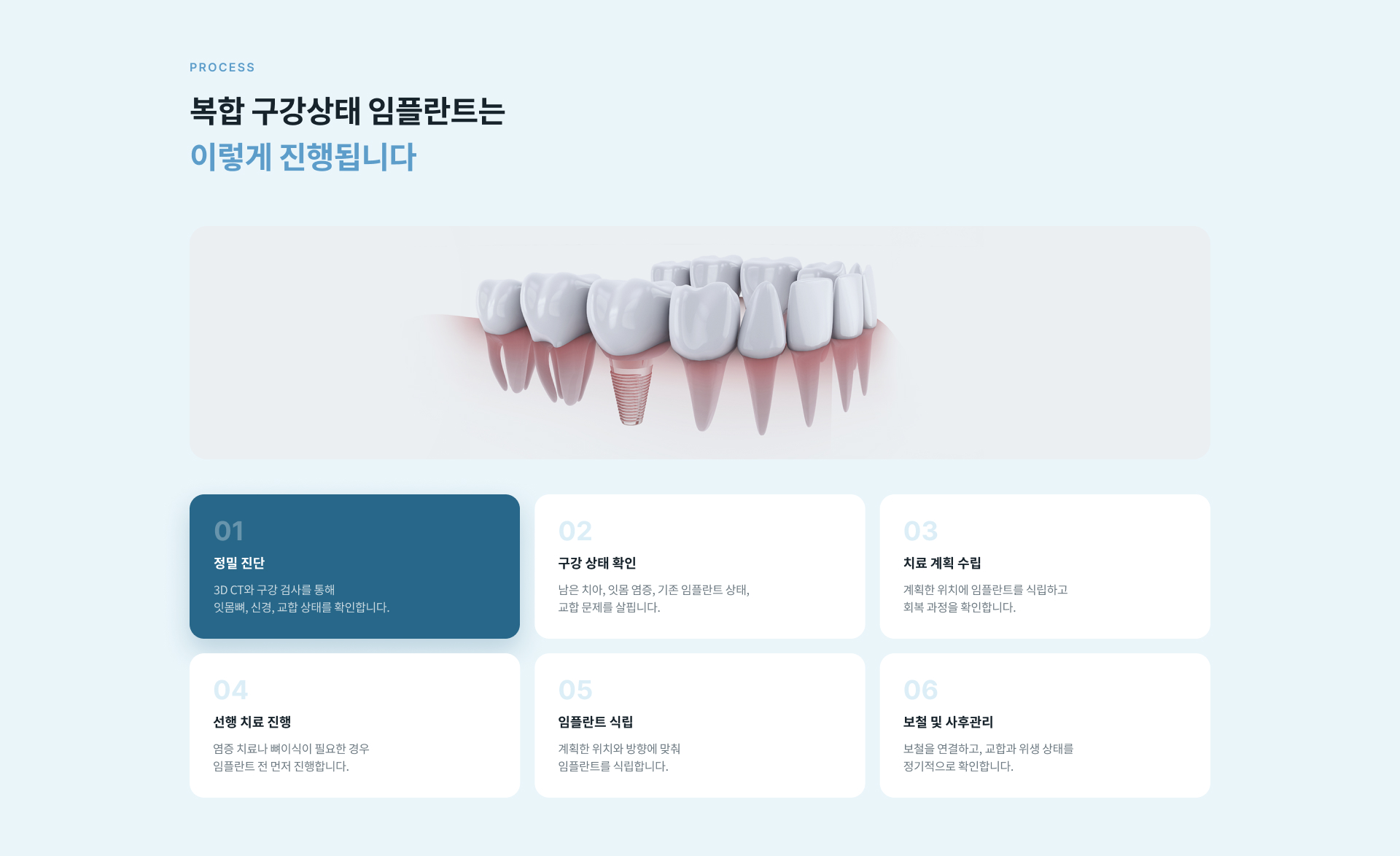 복합 구강상태 임플란트 치료 후 뼈이식과 잇몸 처치 부위 관리, 음식 섭취, 흡연과 음주 및 구강 위생 주의사항