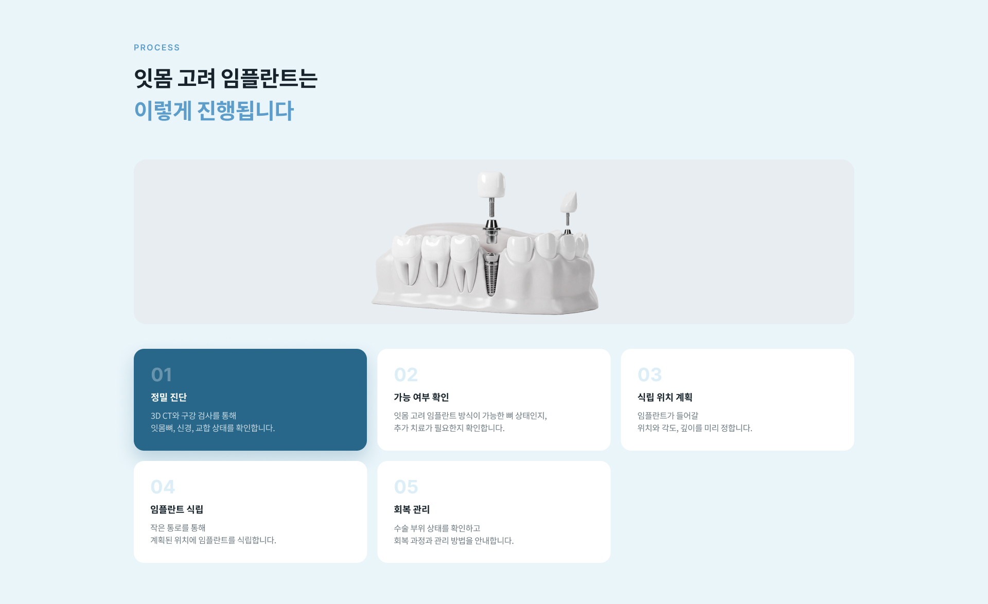 3D CT 정밀 진단부터 가능 여부 확인, 식립 위치 계획, 임플란트 식립 및 회복 관리까지 잇몸 고려 임플란트 치료 과정