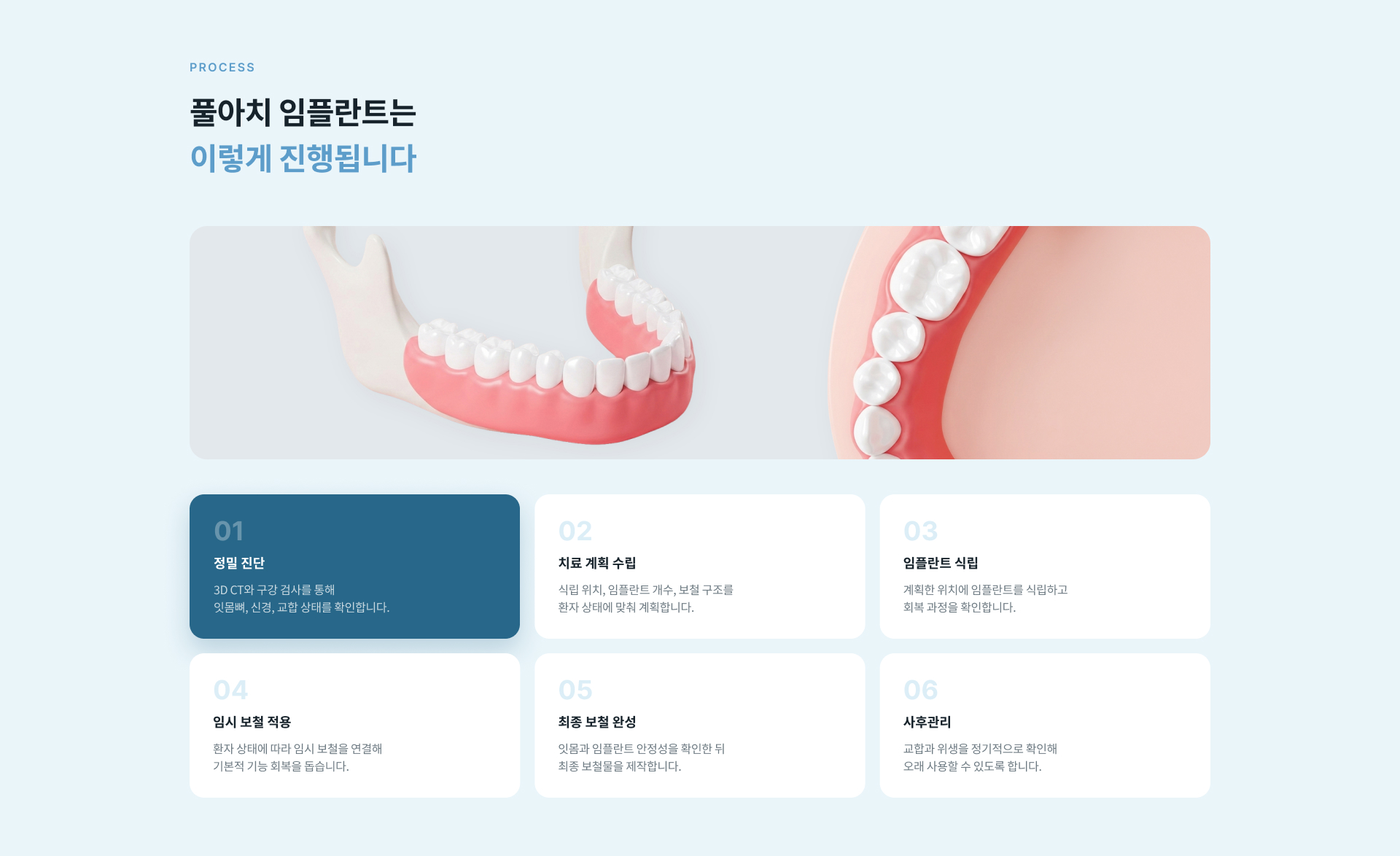3D CT 정밀 진단부터 치료 계획, 임플란트 식립, 임시 보철, 최종 보철 및 사후관리까지 풀아치 임플란트 치료 과정