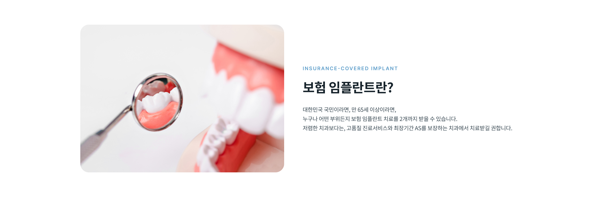 만 65세 이상 건강보험 가입자와 피부양자를 위한 보험 임플란트 치료 및 적용 기준 안내