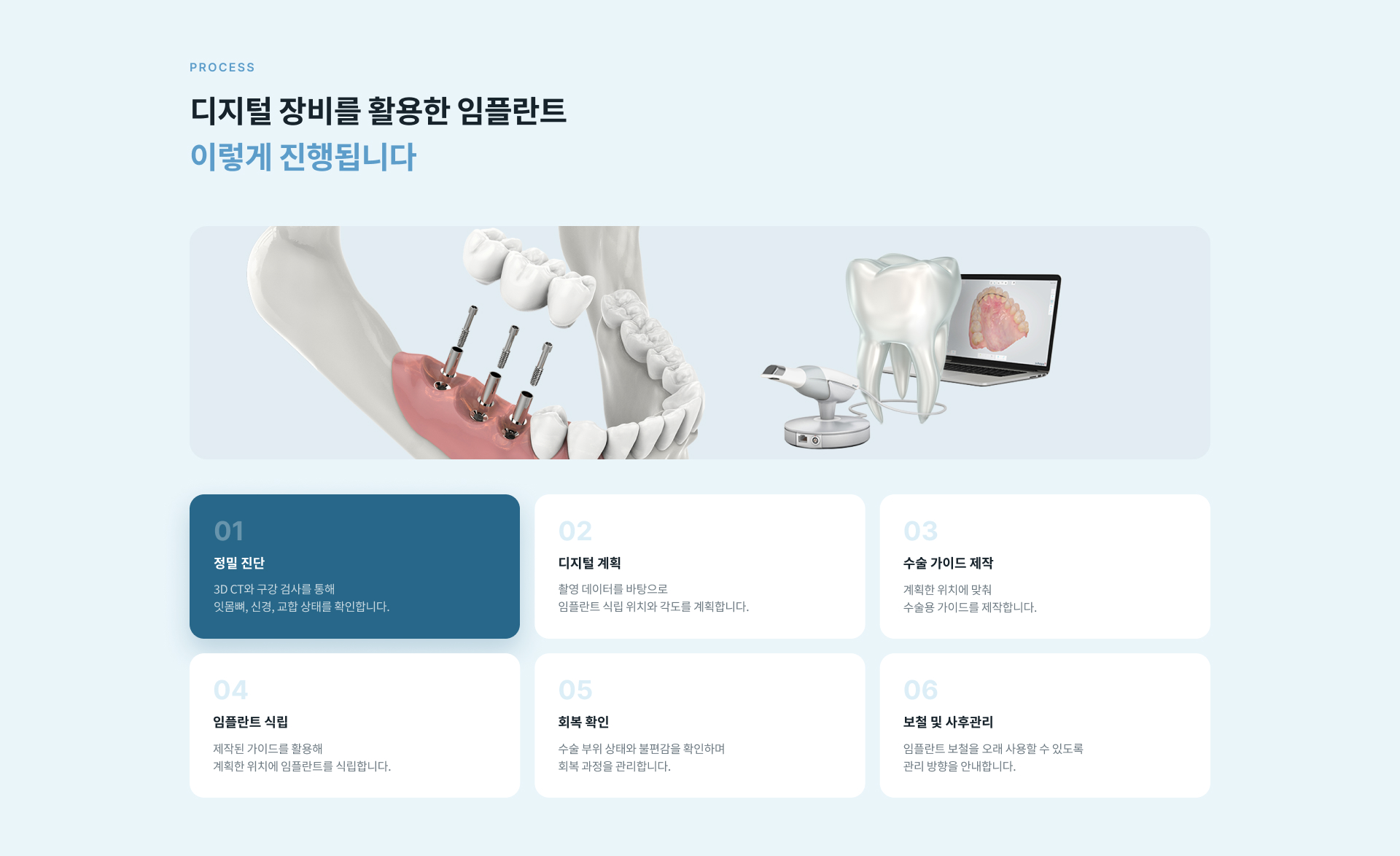 3D CT와 구강 데이터를 기반으로 식립 위치와 각도 및 깊이를 계획하는 디지털 임플란트 치료