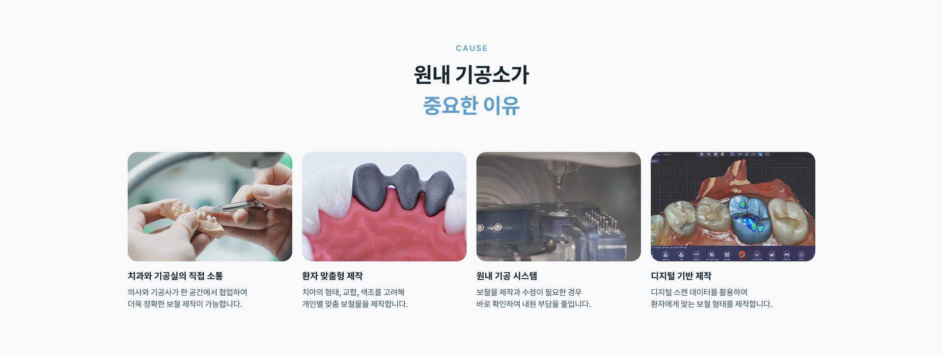 정성플러스치과 원내 기공소에서 제작 가능한 인레이, 온레이, 오버레이, 크라운, 앞니보철, 라미네이트 및 임플란트 보철 안내