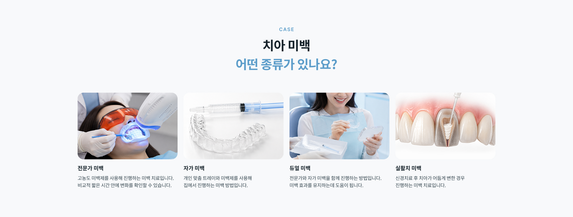 전문가 미백, 자가 미백, 듀얼 미백 및 실활치 미백 등 치아 상태에 따른 치아미백 종류 안내