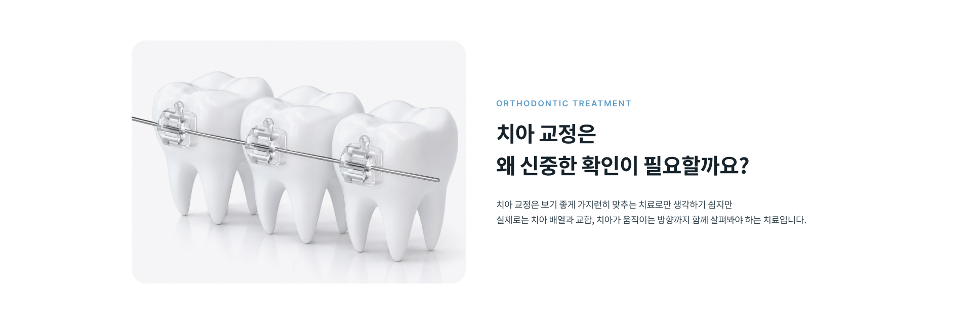 치아 배열과 교합 및 치아 이동 방향을 종합적으로 확인해 진행하는 정성플러스치과 치아교정 치료