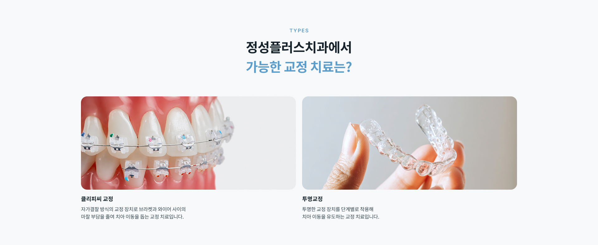 교정과 전문의 협진을 통해 치아 배열과 교합 및 치아 이동 방향을 종합적으로 확인하는 치아교정 치료 안내