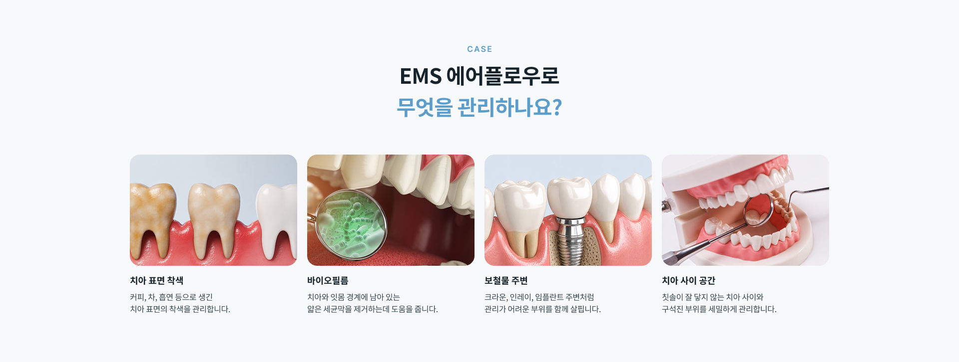 스위스 EMS 에어플로우는 미세한 파우더와 물을 분사해 치아 표면의 바이오필름과 치태, 착색을 부드럽게 제거하는 파우더 클리닝 관리입니다