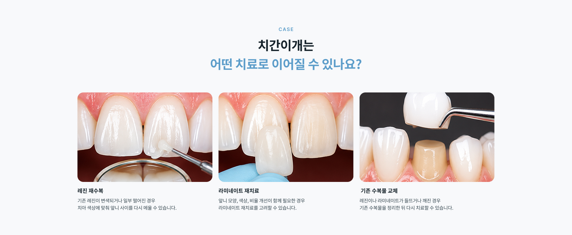 기존에 치료했던 앞니 사이가 다시 벌어져 보이거나 레진과 라미네이트의 변색, 파절, 탈락이 발생한 경우 상태를 확인하고 재치료를 고려할 수 있습니다