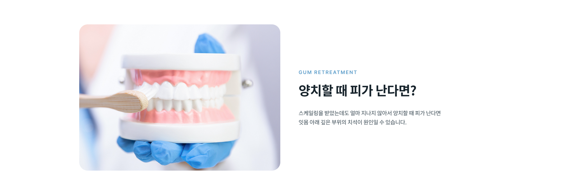 양치나 식사 중 반복되는 잇몸 출혈의 양상과 잇몸 상태, 잇몸 아래 치석과 치주 염증 정도를 확인하는 진료 과정