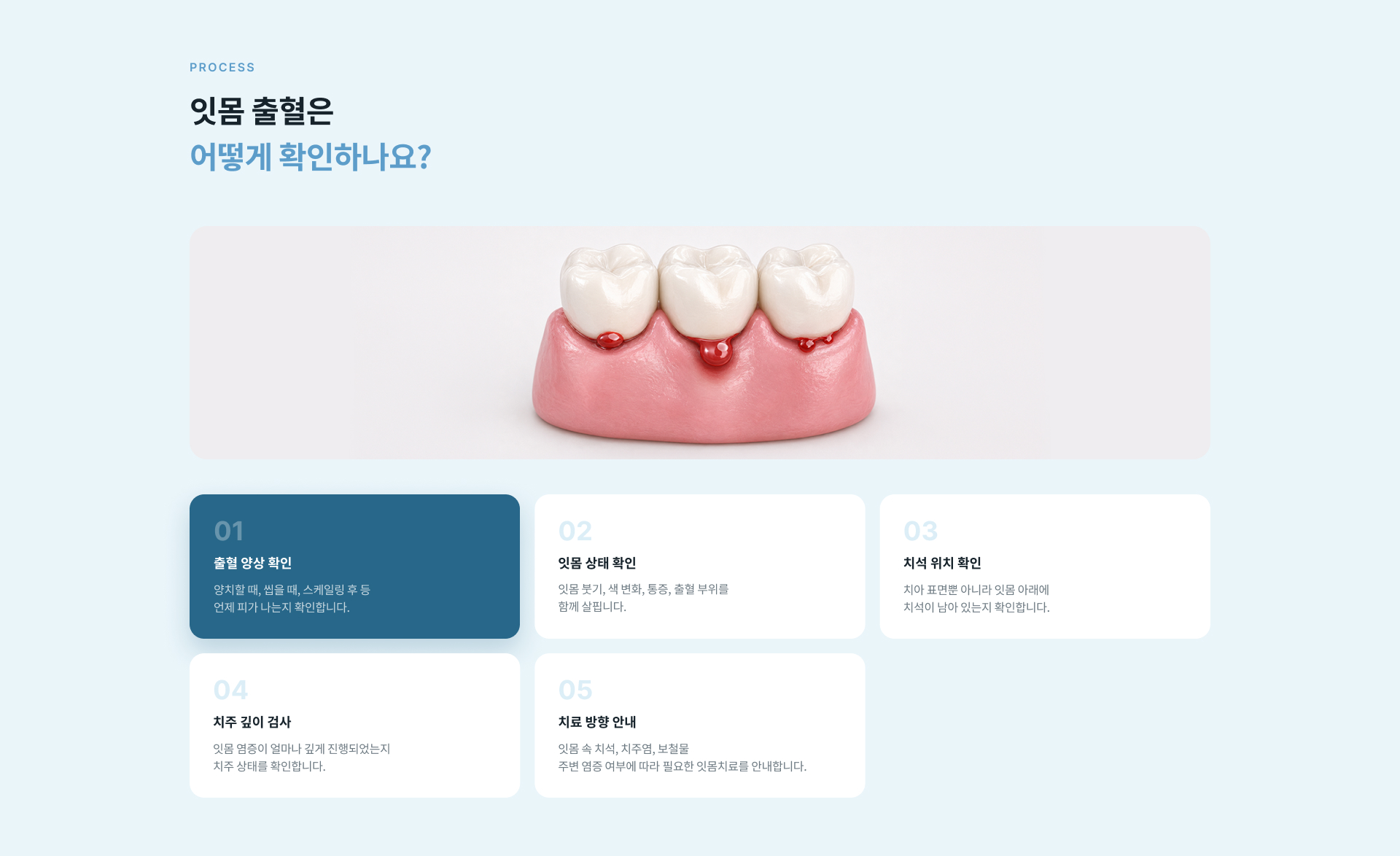 스케일링 후에도 잇몸 출혈이 반복될 때 잇몸 아래 깊은 치석과 염증 여부를 확인하고 필요한 치주 치료를 결정하는 진료