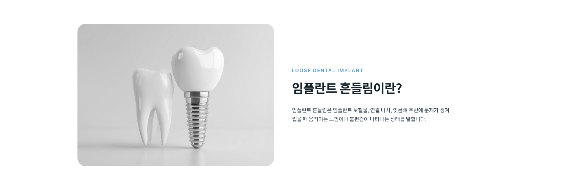 임플란트가 흔들리거나 씹을 때 통증과 불편감이 느껴지는 경우 보철물과 연결 나사, 임플란트 주변 잇몸 및 잇몸뼈 상태를 확인하는 과정