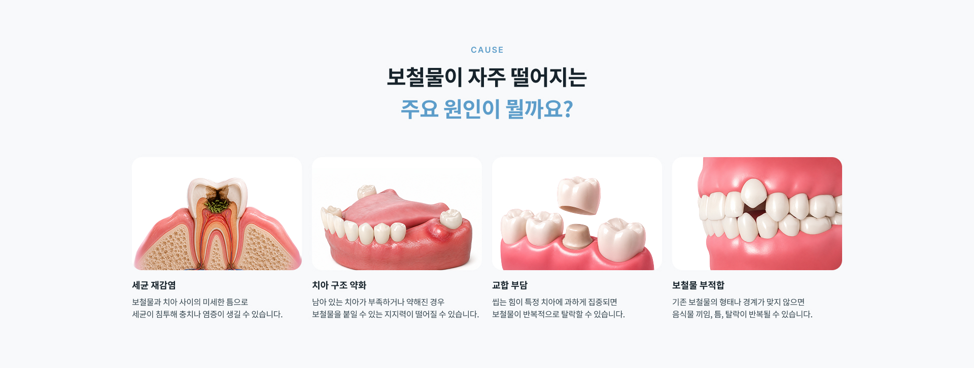 보철물 아래 치아와 접착 상태를 확인해 기존 보철물 재부착이나 재보철, 충치 및 신경치료 등 필요한 치료 방향을 결정하는 과정