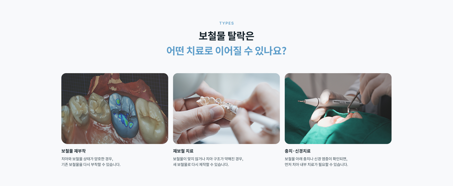 보철물이 반복해서 빠질 때 보철물 아래 충치와 치아 구조 약화, 교합 부담, 기존 보철물의 적합 상태 등 주요 원인을 확인하는 과정