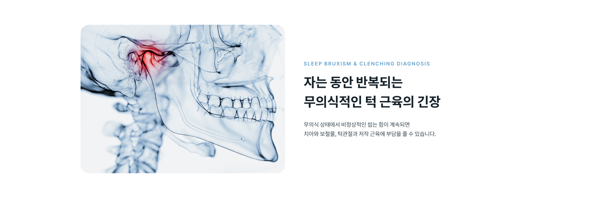 수면 중 반복되는 이갈이와 이악물기 패턴, 턱 근육의 긴장 상태를 확인하는 드림치 웰니스 프로그램