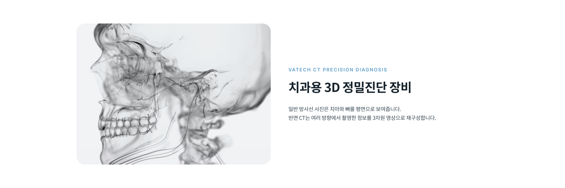 치아와 턱뼈를 여러 방향에서 확인해 턱관절과 치아 상태를 입체적으로 살펴보는 바텍 CT 정밀진단
